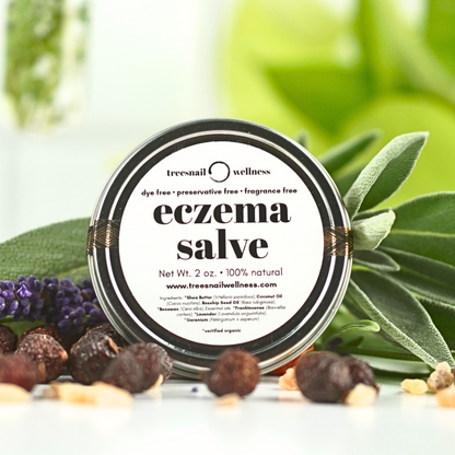 Eczema Salve – Natural Plant-Based Relief for Dry, Irritated Skin